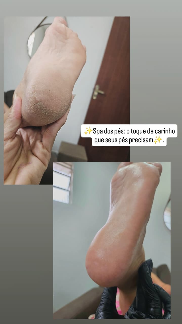 Spa dos pés — antes e depois